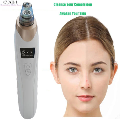 Blackhead Remover Vacuum Pore Cleaner Multi Suction Heads Adjustable Suction USB Rechargeable Deep Cleansing Skin Tool Gifts