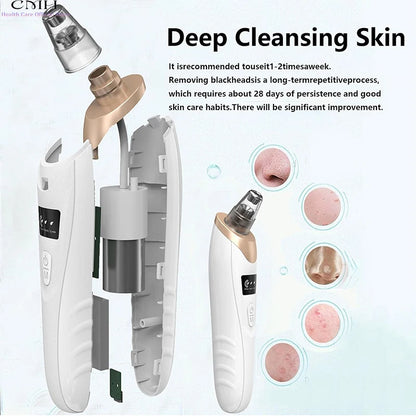 Blackhead Remover Vacuum Pore Cleaner Multi Suction Heads Adjustable Suction USB Rechargeable Deep Cleansing Skin Tool Gifts